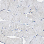 Immunohistochemical staining of human skeletal muscle shows no positivity in myocytes as expected.