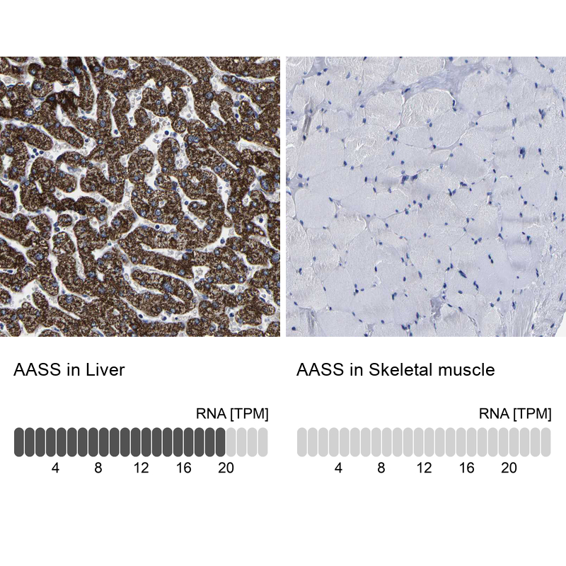 Anti-AASS Antibody