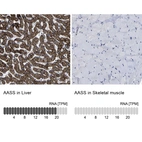 Anti-AASS Antibody