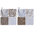 Immunohistochemical staining of human endometrium, kidney, liver and skeletal muscle using Anti-AASS antibody HPA020728 (A) shows similar protein distribution across tissues to independent antibody HPA020734 (B).