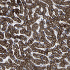 Immunohistochemical staining of human liver shows strong granular cytoplasmic positivity in hepatocytes.