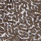 Immunohistochemical staining of human liver shows strong granular cytoplasmic positivity in hepatocytes.