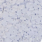 Immunohistochemical staining of human skeletal muscle shows no positivity in myocytes as expected.