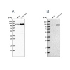Western blot analysis using Anti-AASS antibody HPA020728 (A) shows similar pattern to independent antibody HPA020637 (B).