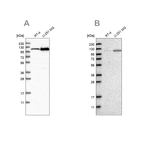 Western blot analysis using Anti-AASS antibody HPA020728 (A) shows similar pattern to independent antibody HPA020637 (B).