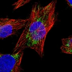 Immunofluorescent staining of human cell line U-251 MG shows localization to mitochondria.