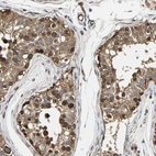 Anti-GFRA3 Antibody