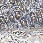 Immunohistochemical staining of human duodenum shows moderate cytoplasmic positivity in glandular cells.