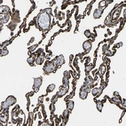 Immunohistochemical staining of human lung shows strong membranous positivity in pneumocytes.