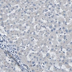 Immunohistochemical staining of human liver shows no positivity in hepatocytes as expected.