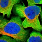 Immunofluorescent staining of human cell line U-2 OS shows localization to plasma membrane & cytosol.