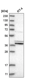 Western blot analysis in human cell line RT-4.