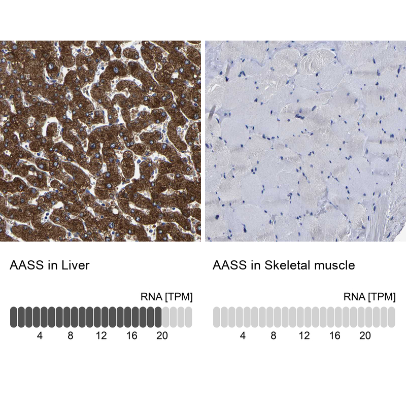 Anti-AASS Antibody