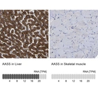 Anti-AASS Antibody