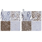 Immunohistochemical staining of human endometrium, kidney, liver and skeletal muscle using Anti-AASS antibody HPA020734 (A) shows similar protein distribution across tissues to independent antibody HPA020637 (B).
