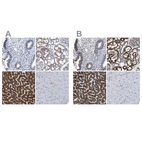 Immunohistochemical staining of human endometrium, kidney, liver and skeletal muscle using Anti-AASS antibody HPA020734 (A) shows similar protein distribution across tissues to independent antibody HPA020728 (B).