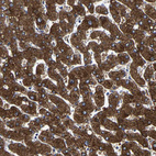 Immunohistochemical staining of human liver shows strong granular cytoplasmic positivity in hepatocytes.