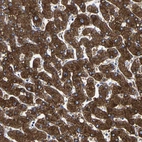 Immunohistochemical staining of human liver shows strong granular cytoplasmic positivity in hepatocytes.