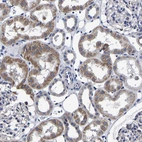 Immunohistochemical staining of human kidney shows moderate granular cytoplasmic positivity in cells in tubules.