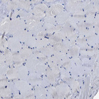 Immunohistochemical staining of human skeletal muscle shows no positivity in myocytes as expected.