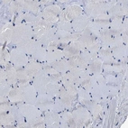 Immunohistochemical staining of human skeletal muscle shows no positivity in myocytes as expected.