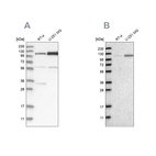 Western blot analysis using Anti-AASS antibody HPA020734 (A) shows similar pattern to independent antibody HPA020637 (B).