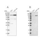Western blot analysis using Anti-AASS antibody HPA020734 (A) shows similar pattern to independent antibody HPA020637 (B).