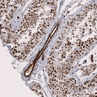 Immunohistochemical staining of human testis shows strong cytoplasmic positivity in endothelial cells and nuclear positvity in cells in seminiferous ducts.