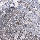 Immunohistochemical staining of human colon shows strong cytoplasmic positivity in endothelial cells.