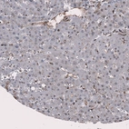 Immunohistochemical staining of human liver shows weak cytoplasmic positivity in endothelial cells and no positivity in hepatocytes.