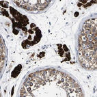 Immunohistochemical staining of human testis shows strong cytoplasmic positivity in Leydig cells.