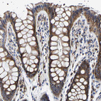 Immunohistochemical staining of human colon shows moderate cytoplasmic positivity in glandular cells.
