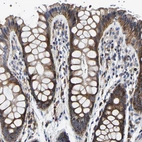 Immunohistochemical staining of human colon shows moderate cytoplasmic positivity in glandular cells.