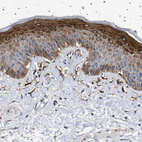 Immunohistochemical staining of human skin shows moderate cytoplasmic positivity in squamous epithelial cells.