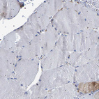 Immunohistochemical staining of human skeletal muscle shows no positivity in myocytes as expected.
