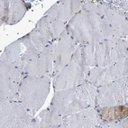 Immunohistochemical staining of human skeletal muscle shows no positivity in myocytes as expected.