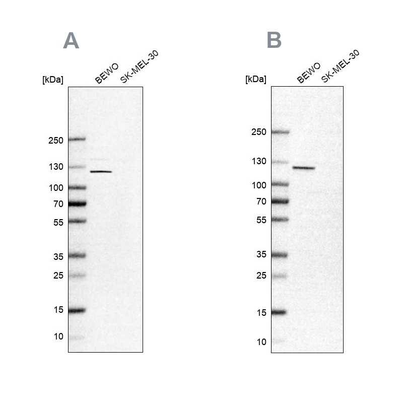Anti-NLRP2 Antibody