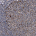 Immunohistochemical staining of human tonsil shows moderate cytoplasmic positivity in germinal center cells.