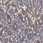 Immunohistochemical staining of human duodenum shows moderate cytoplasmic positivity in glandular cells.