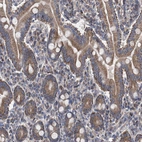 Immunohistochemical staining of human duodenum shows moderate cytoplasmic positivity in glandular cells.
