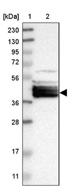 Lane 1: Marker [kDa] 230, 130, 95, 72, 56, 36, 28, 17, 11_br/_Lane 2: Human cell line RT-4