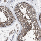 Immunohistochemical staining of human testis shows moderate cytoplasmic positivity in cells in seminiferous ducts.