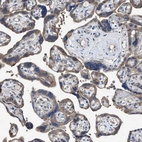 Immunohistochemical staining of human placenta shows moderate cytoplasmic positivity in trophoblastic cells.