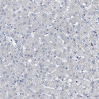 Immunohistochemical staining of human liver shows no positivity in hepatocytes as expected.