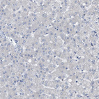 Anti-UPF1 Antibody