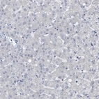 Immunohistochemical staining of human liver shows no positivity in hepatocytes as expected.