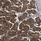 Anti-PPM1K Antibody