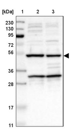 Lane 1: Marker [kDa] 230, 130, 95, 72, 56, 36, 28, 17, 11_br/_Lane 2: Human cell line RT-4_br/_Lane 3: Human cell line U-251MG sp