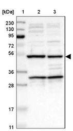 Lane 1: Marker [kDa] 230, 130, 95, 72, 56, 36, 28, 17, 11_br/_Lane 2: Human cell line RT-4_br/_Lane 3: Human cell line U-251MG sp