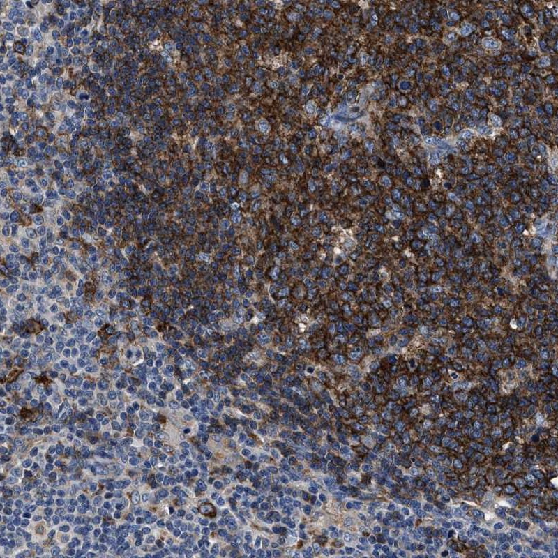 Anti-C2orf66 Antibody